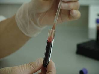 A blood test